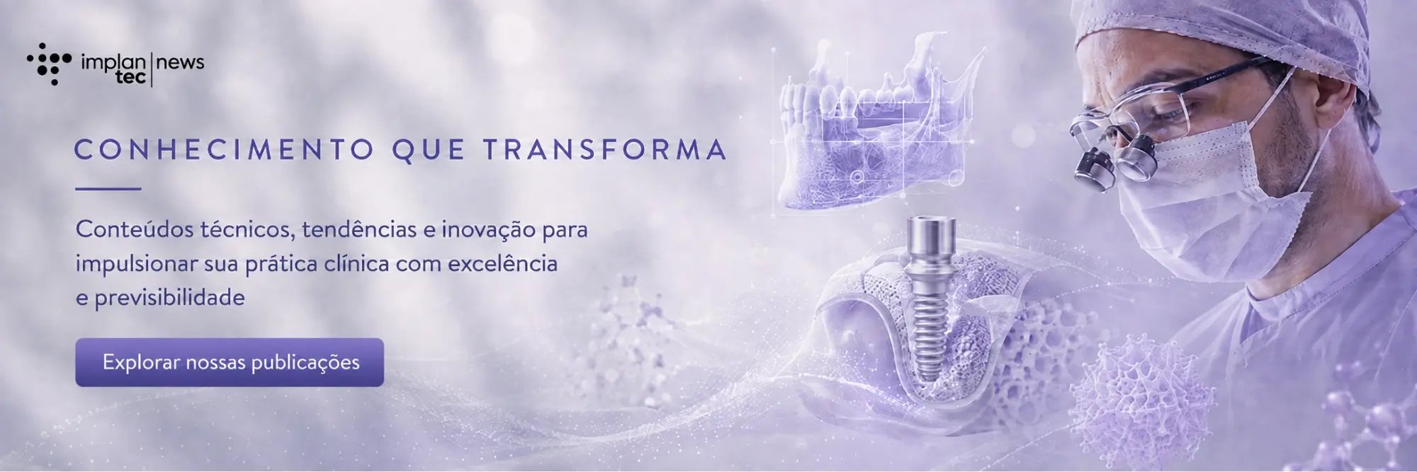 Blog Implantec News